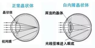 /uploads/image/2019/10/17/664bbe5d718abbfeb05972053569c5d2.jpg /uploads/image/2019/10/17/664bbe5d718abbfeb05972053569c5d2.jpg